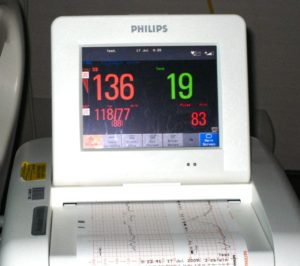 HeartMonitor - Touching & Technology: A Fugal July